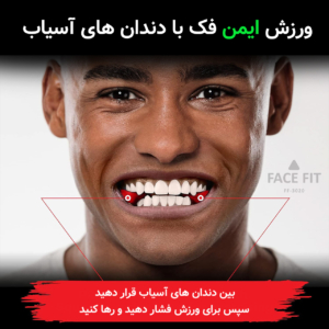زاویه ساز فک و صورت فیس فیت مدل FF-3020 بسته 6 عددی - تصویر 8